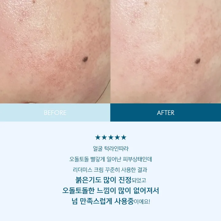 상품 썸네일