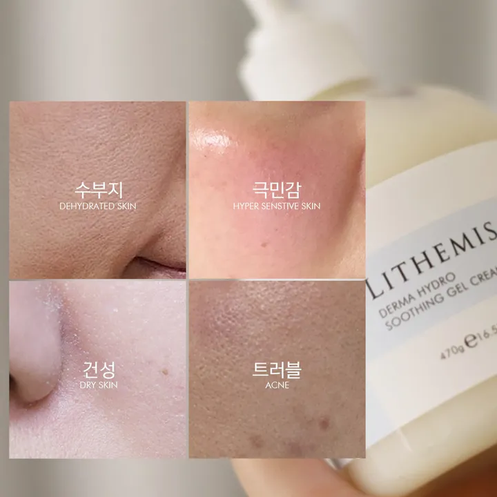 상품 썸네일